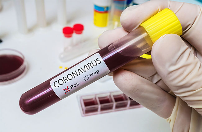 Positive Coronavirus Test